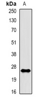 Rac 1 (Phospho-S71) Rabbit Polyclonal Antibody
