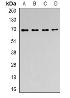 ACAD9 Rabbit Polyclonal Antibody
