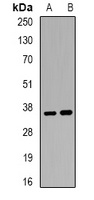 ACP5 Rabbit Polyclonal Antibody