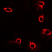 ACP5 Rabbit Polyclonal Antibody