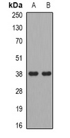 ADH5 Rabbit Polyclonal Antibody