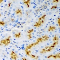 p43 Rabbit Polyclonal Antibody