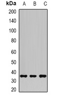 AKR1C3 Rabbit Polyclonal Antibody