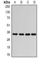 AKR1C4 Rabbit Polyclonal Antibody