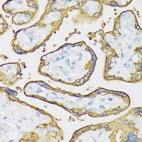 ALPP Rabbit Polyclonal Antibody