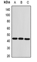 AMACR Rabbit Polyclonal Antibody