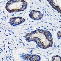 AMACR Rabbit Polyclonal Antibody