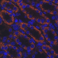 AMACR Rabbit Polyclonal Antibody