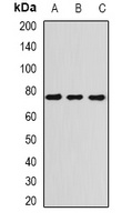 ATR Rabbit Polyclonal Antibody