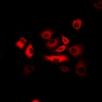 ATR Rabbit Polyclonal Antibody