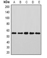 Annexin A11 Rabbit Polyclonal Antibody