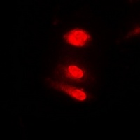 Annexin A11 Rabbit Polyclonal Antibody