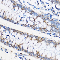 Apolipoprotein M Rabbit Polyclonal Antibody