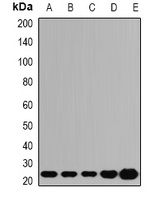 ATP5O Rabbit Polyclonal Antibody