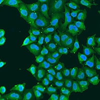 ATP5O Rabbit Polyclonal Antibody