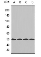 CBX8 Rabbit Polyclonal Antibody