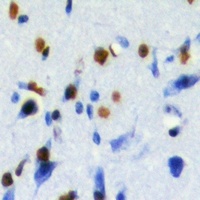 CBX8 Rabbit Polyclonal Antibody