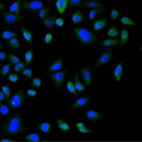CBX8 Rabbit Polyclonal Antibody