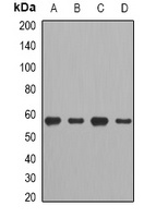 CCT2 Rabbit Polyclonal Antibody