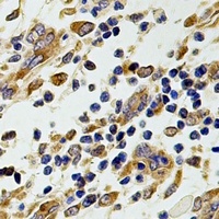 CCT2 Rabbit Polyclonal Antibody