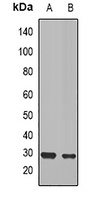 CD151 Rabbit Polyclonal Antibody
