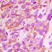 CD151 Rabbit Polyclonal Antibody