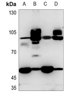 CD36 Rabbit Polyclonal Antibody