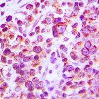 CD38 Rabbit Polyclonal Antibody