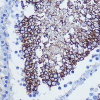 CD47 Rabbit Polyclonal Antibody
