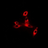 CD47 Rabbit Polyclonal Antibody