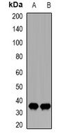 CDK20 Rabbit Polyclonal Antibody