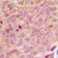 CDK20 Rabbit Polyclonal Antibody