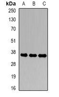 CDK6 Rabbit Polyclonal Antibody