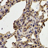 CDK6 Rabbit Polyclonal Antibody