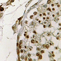 CIRBP Rabbit Polyclonal Antibody