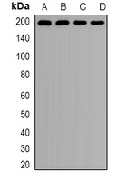 Clathrin Heavy Chain Rabbit Polyclonal Antibody