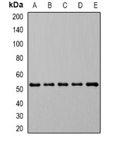 DHODH Rabbit Polyclonal Antibody