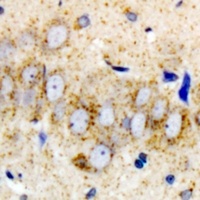 DHODH Rabbit Polyclonal Antibody