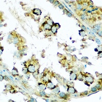 SMAC Rabbit Polyclonal Antibody