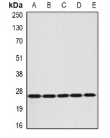 DIRAS3 Rabbit Polyclonal Antibody
