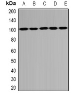 PSD95 Rabbit Polyclonal Antibody