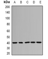 DNAJB6 Rabbit Polyclonal Antibody
