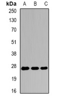 EIF6 Rabbit Polyclonal Antibody