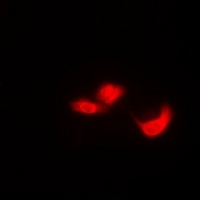 EIF6 Rabbit Polyclonal Antibody