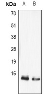FABP5 Rabbit Polyclonal Antibody