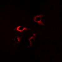 FKBP8 Rabbit Polyclonal Antibody