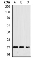Ferritin L Rabbit Polyclonal Antibody