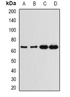 G6PD Rabbit Polyclonal Antibody