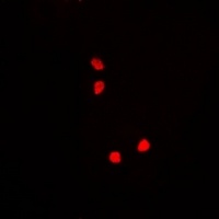 Nucleostemin Rabbit Polyclonal Antibody