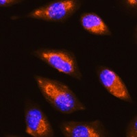 GLURD1 Rabbit Polyclonal Antibody